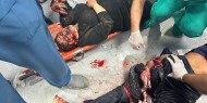 مراسلنا: 37 شهيدا وصلوا مستشفى شهداء الاقصى جراء غارات الاحتلال المتواصلة على قطاع غزة